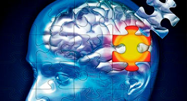 Alzheimer