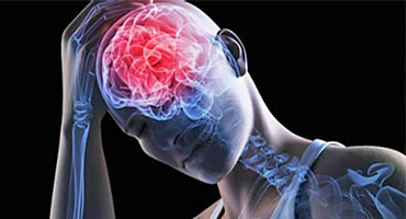 Derrame cerebral