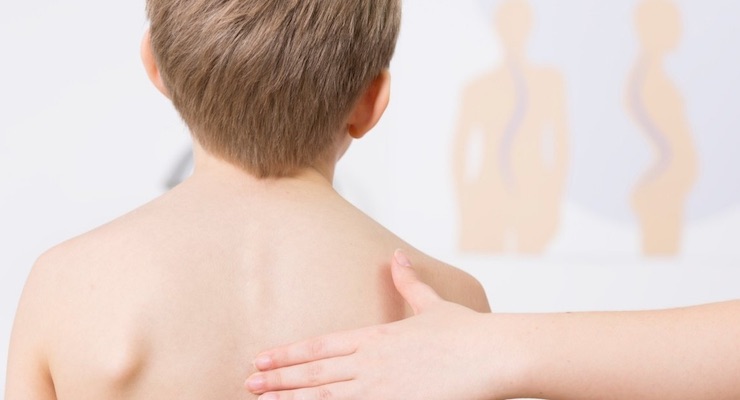 Escoliosis en jóvenes y niños