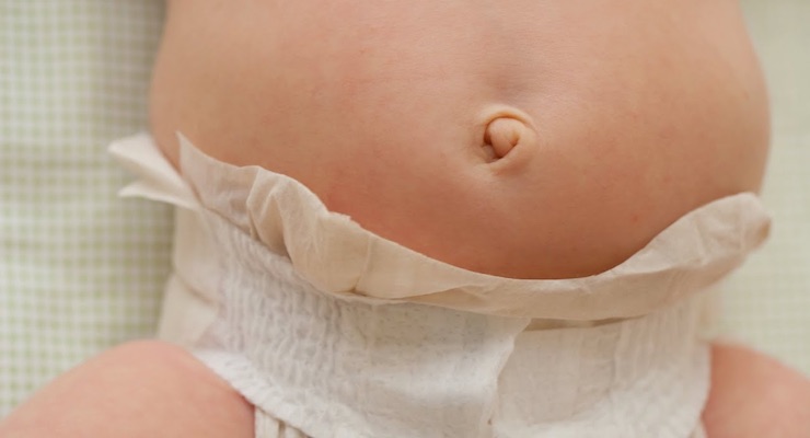 Ombligo del Recién Nacido - Maternidad - Hospital Clínica Bíblica - Oncolgæia Quirúrgica Pediátrica